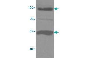 Western blot analysis of human fetal liver lysate with ADAMTS8 polyclonal antibody  at 1 : 1000 dilution.