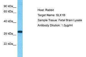 Host: Rabbit Target Name: SLX1B Sample Type: Fetal Brain lysates Antibody Dilution: 1. (SLX1A/GIYD2 抗体  (N-Term))