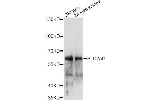 Western blot analysis of extracts of various cell lines, using SLC2A9 antibody (ABIN6291465) at 1:1000 dilution. (SLC2A9 抗体)