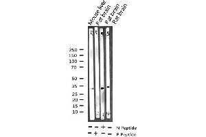 Western blot analysis of Phospho-NPM (Thr199) expression in various lysates (NPM1 抗体  (pThr199))