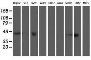 Image no. 5 for anti-Aminoacylase 1 (ACY1) antibody (ABIN1496453) (Aminoacylase 1 抗体)