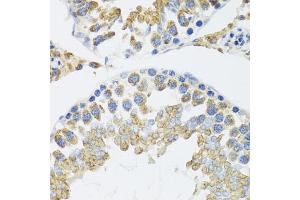 Immunohistochemistry of paraffin-embedded mouse testis using POLG2 antibody (ABIN6132502, ABIN6145894, ABIN6145895 and ABIN6222405) at dilution of 1:100 (40x lens).