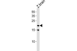 Western Blotting (WB) image for anti-Transcription Factor 21 (TCF21) antibody (ABIN3004721) (TCF21 抗体)