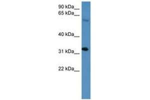 Image no. 1 for anti-Homeobox D13 (HOXD13) (AA 174-223) antibody (ABIN6746038) (Homeobox D13 抗体  (AA 174-223))