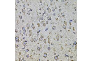 Immunohistochemistry of paraffin-embedded mouse brain using CRHR1 antibody (ABIN5974846) at dilution of 1/100 (40x lens). (CRHR1 抗体)
