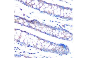 Immunohistochemistry of paraffin-embedded human colon using DUSP6 Rabbit mAb (ABIN7266848) at dilution of 1:100 (40x lens). (DUSP6 抗体)