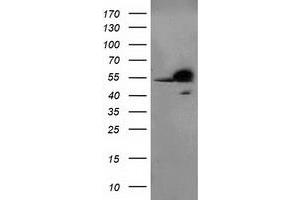 Western Blotting (WB) image for anti-Retinoblastoma Binding Protein 7 (RBBP7) antibody (ABIN1500626) (RBBP7 抗体)