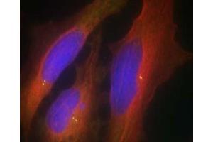 Image no. 1 for anti-Synaptotagmin I (SYT1) (Ser309) antibody (ABIN401634)