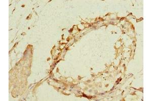 Immunohistochemistry of paraffin-embedded human testis tissue using ABIN7169096 at dilution of 1:100 (NEK11 抗体  (AA 245-482))