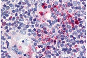 Human Thymus (formalin-fixed, paraffin-embedded) stained with USP4 antibody ABIN213584 at 5 ug/ml followed by biotinylated goat anti-rabbit IgG secondary antibody ABIN481713, alkaline phosphatase-streptavidin and chromogen. (USP4 抗体  (N-Term))