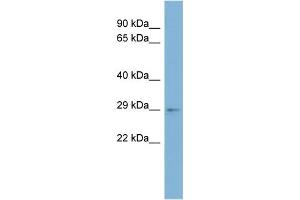WB Suggested Anti-ARV1 Antibody Titration:  0.