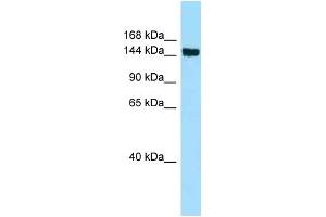 WB Suggested Anti-CD109 Antibody Titration: 1. (CD109 抗体  (Middle Region))