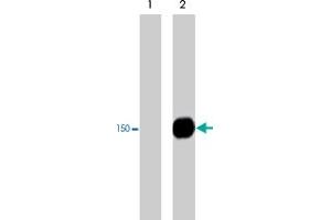 Western blot analysis of PLCG1 immunoprecipitates from human Jurkat cells untreated (lane 1) or treated with pervanadate (1 mM) for 30 min (lane 2). (Phospholipase C gamma 1 抗体  (pTyr775))