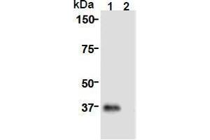 Western Blotting (WB) image for anti-Cell Division Cycle Associated 8 (CDCA8) (AA 1-280), (N-Term) antibody (ABIN1449290) (CDCA8 抗体  (N-Term))