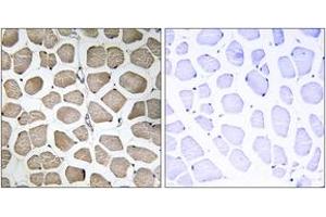 Immunohistochemistry analysis of paraffin-embedded human skeletal muscle tissue, using MOT12 Antibody. (MOT12 抗体  (AA 115-164))