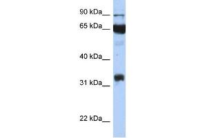 WB Suggested Anti-PTGS1 Antibody Titration:  0. (PTGS1 抗体  (Middle Region))