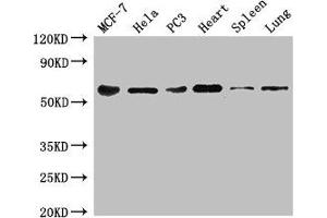 Western Blot Positive WB detected in: MCF-7 whole cell lysate, Hela whole cell lysate, PC-3 whole cell lysate, Mouse heart tissue, Mouse spleen tissue, Mouse lung tissue All lanes: TROVE2 antibody at 3 μg/mL Secondary Goat polyclonal to rabbit IgG at 1/50000 dilution Predicted band size: 61, 24, 59, 60 kDa Observed band size: 61 kDa (TROVE2 抗体  (AA 3-535))