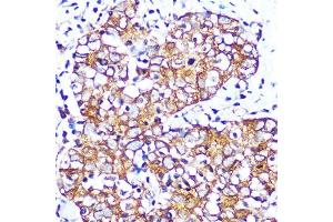 Immunohistochemistry (IHC) image for anti-Cholinergic Receptor, Muscarinic 2 (CHRM2) antibody (ABIN7266346)