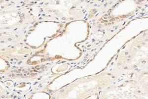 Immunohistochemistry analysis of paraffin-embedded human kidney using,MTND1 (ABIN7074658) at dilution of 1: 1000 (MT-ND1 抗体)