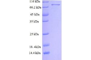 SDS-PAGE (SDS) image for Neuroepithelial Cell Transforming 1 (NET1) (AA 1-542), (Isoform 2) protein (His-SUMO Tag) (ABIN5711473)