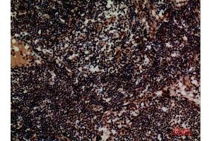 Immunohistochemistry (IHC) image for anti-Integrin alpha 4 (ITGA4) (Internal Region) antibody (ABIN6287306)