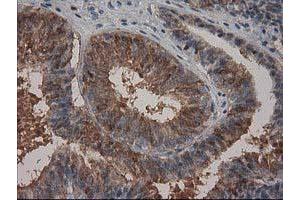 Immunohistochemistry (IHC) image for anti-Hydroxyprostaglandin Dehydrogenase 15-(NAD) (HPGD) antibody (ABIN1496362) (HPGD 抗体)