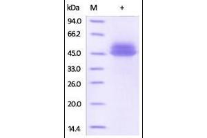 SDS-PAGE (SDS) image for Interleukin 12 beta (IL12B) (AA 23-328) (Active) protein (His tag) (ABIN2181334) (IL12B Protein (AA 23-328) (His tag))