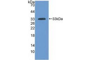 Detection of Recombinant LAMa3, Human using Polyclonal Antibody to Laminin Alpha 3 (LAMa3) (LAMA3 抗体  (AA 47-296))