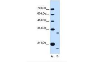 Image no. 1 for anti-Cell Cycle Progression 1 (CCPG1) (AA 301-350) antibody (ABIN6738251) (CCPG1 抗体  (AA 301-350))