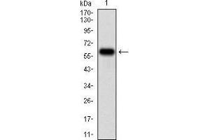 Western blot analysis using TIE1 mAb against human TIE1 (AA: 385-607) recombinant protein. (TIE1 抗体  (AA 385-607))