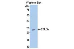 Western Blotting (WB) image for anti-Cartilage Oligomeric Matrix Protein (COMP) (AA 235-423) antibody (ABIN1858467)