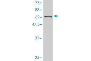 Western Blot detection against Immunogen (67. (CTNNA3 抗体  (AA 1-376))