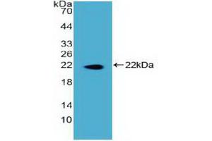 Western blot analysis of recombinant Human DKC. (DKC1 抗体  (AA 298-465))