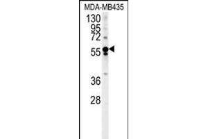 ARHGEF3 Antibody (Center) (ABIN652003 and ABIN2840492) western blot analysis in MDA-M cell line lysates (35 μg/lane). (ARHGEF3 抗体  (AA 211-240))