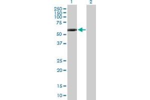 Western Blot analysis of GPI expression in transfected 293T cell line by GPI MaxPab polyclonal antibody. (GPI 抗体  (AA 1-558))