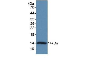 Western Blotting (WB) image for anti-V-Set Domain Containing T Cell Activation Inhibitor 1 (VTCN1) (AA 34-147) antibody (ABIN7426796)