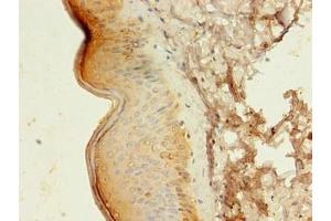 Immunohistochemistry of paraffin-embedded human skin tissue using ABIN7145104 at dilution of 1:100 (ATG16L1 抗体  (AA 1-607))