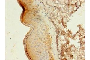 Immunohistochemistry of paraffin-embedded human skin tissue using ABIN7145104 at dilution of 1:100
