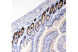 Immunohistochemistry (IHC) image for anti-Solute Carrier Family 12 (Potassium-Chloride Transporter) Member 2 (SLC12A2) (AA 223-241), (N-Term) antibody (ABIN3043994)
