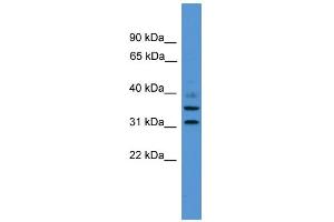 WB Suggested Anti-GIMAP6 Antibody Titration: 0. (GIMAP6 抗体  (C-Term))