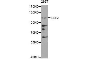 Western blot analysis of extracts of 293T cells, using EEF2 antibody. (EEF2 抗体)