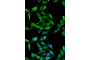Immunofluorescence analysis of U2OS cells using GAMT antibody. (GAMT 抗体  (AA 1-236))
