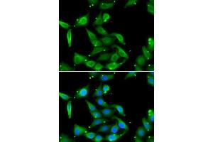 Immunofluorescence analysis of U2OS cells using GAMT antibody. (GAMT 抗体  (AA 1-236))