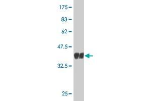 Western Blot detection against Immunogen (36. (CDC14A 抗体  (AA 431-530))