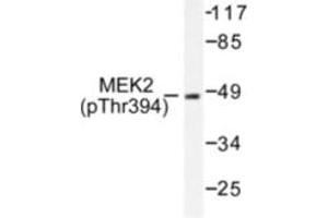Image no. 1 for anti-Mitogen-Activated Protein Kinase Kinase 2 (MAP2K2) (pThr394) antibody (ABIN318069) (MEK2 抗体  (pThr394))