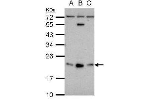 WB Image Sample (30 ug of whole cell lysate) A: NT2D1 B: PC-3 C: U87-MG 12% SDS PAGE antibody diluted at 1:500 (GLIPR1L1 抗体  (Center))