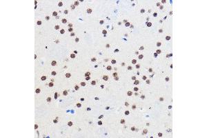 Immunohistochemistry of paraffin-embedded Mouse brain using GTF3C3 Rabbit pAb (ABIN7267374) at dilution of 1:100 (40x lens). (GTF3C3 抗体)