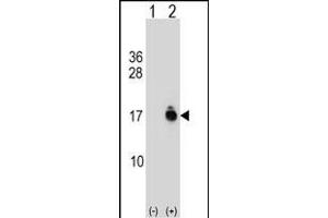 Western Blotting (WB) image for anti-Acylphosphatase 1, Erythrocyte (Common) Type (Acyp1) (AA 52-80), (C-Term) antibody (ABIN1537423)