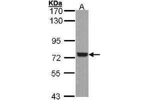 WB Image Sample (30 ug of whole cell lysate) A: A431 , 7. (SYK 抗体  (Internal Region))