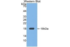 Detection of Recombinant FN, Mouse using Polyclonal Antibody to Fibronectin (FN) (Fibronectin 抗体  (AA 2117-2236))